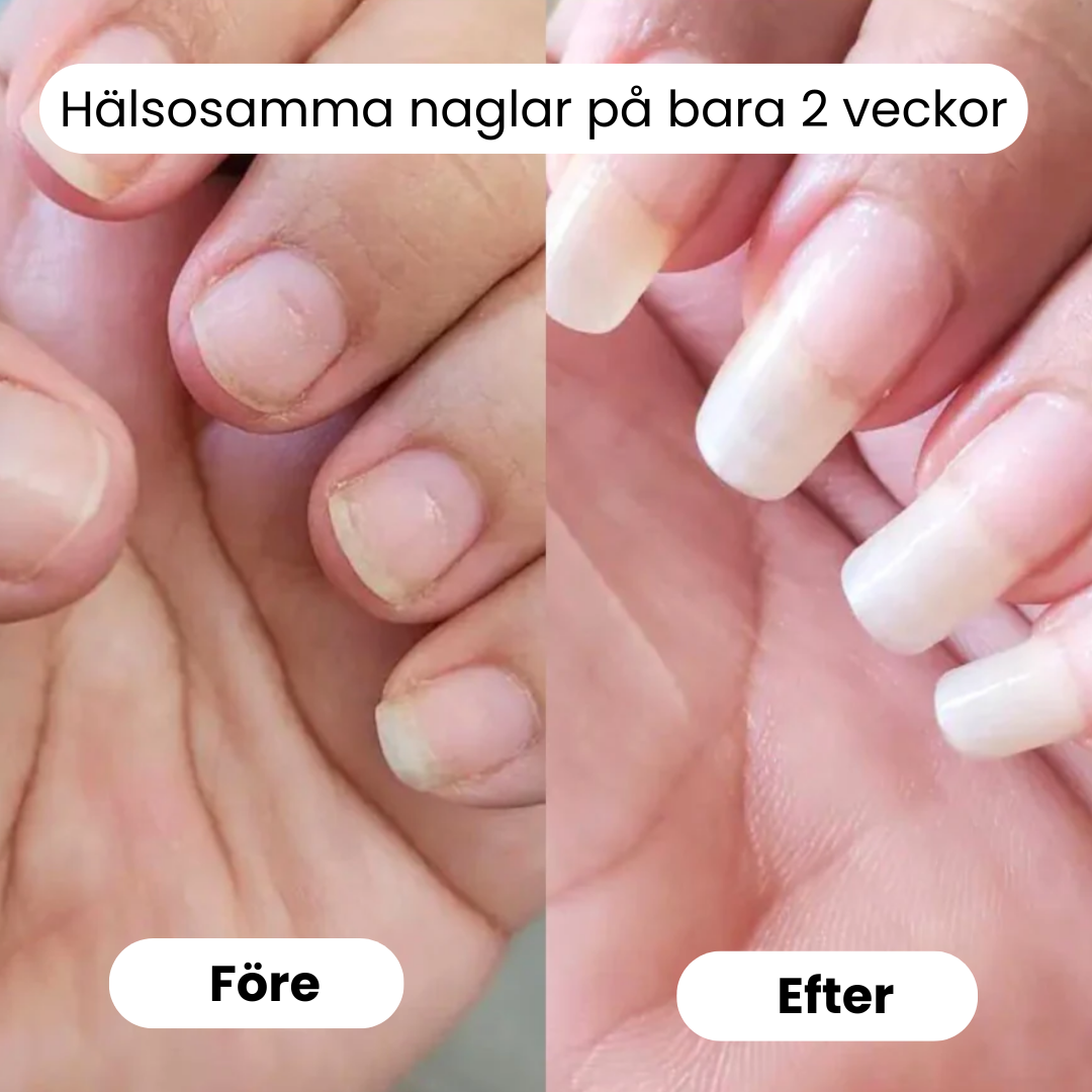 Starka naglar, starkare självförtroende!